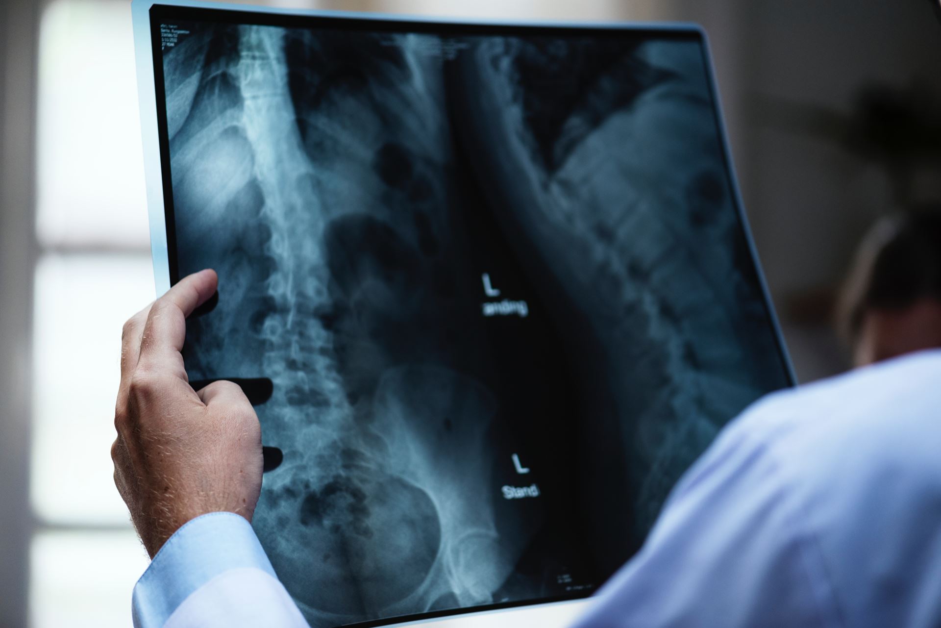 a doctor holding an x-ray